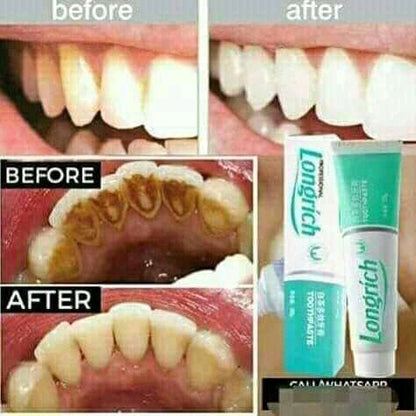 Dentifrice multi-effets
